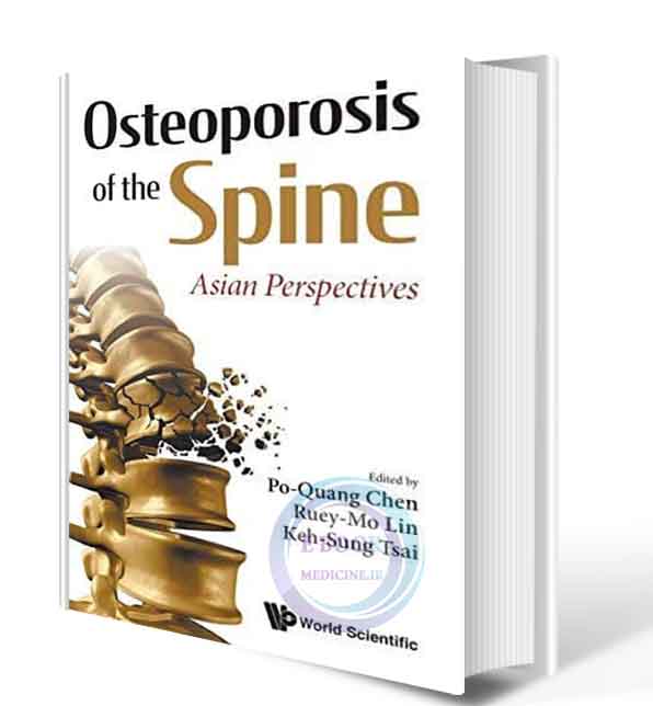 دانلود کتاب Osteoporosis of the Spine: Asian Perspectives 2021 (ORIGINAL PDF)